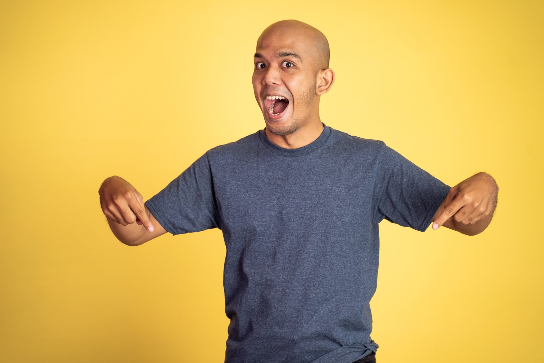 Excited Bald Young Man with Two Fingers Pointing down